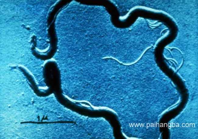 世界上最危险的10种细菌 结核分枝杆菌位居榜首